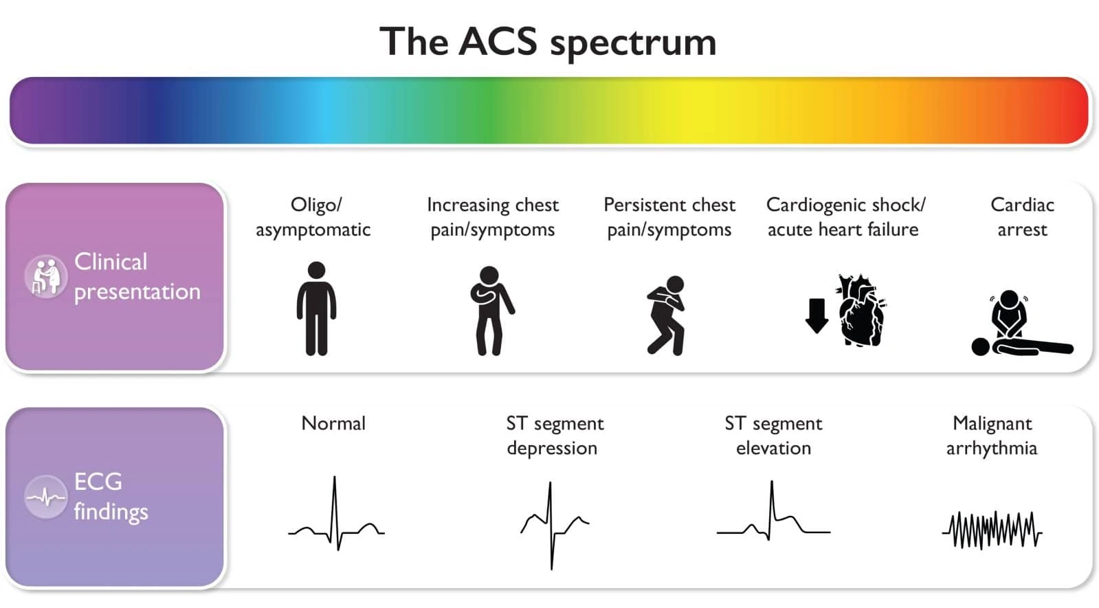 The ACS spectrum chart mapping clinical presentations to ECG findings from normal to malignant arrhythmia