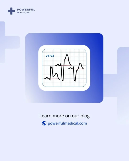 Powerful Medical blog outro card with a stylized ECG waveform in leads V1-V3