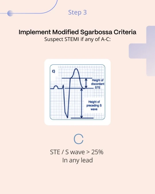 Modified Sgarbossa criterion C: discordant ST elevation to S-wave ratio over 25 percent