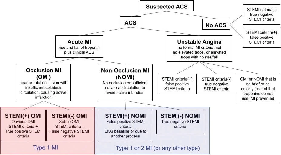 Classification tree dividing suspected ACS into OMI and NOMI subtypes by STEMI criteria and troponin