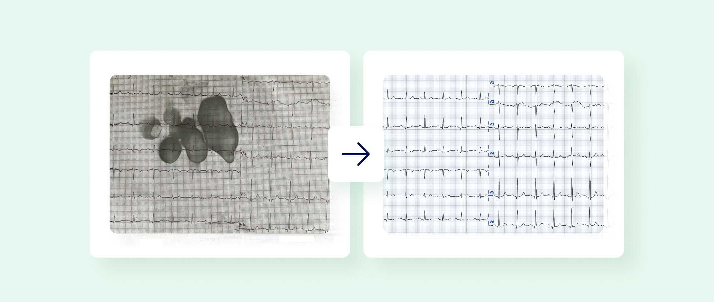An image of a stained, poor-quality ECG and next to it a corrected ECG recording digitized by PMcardio