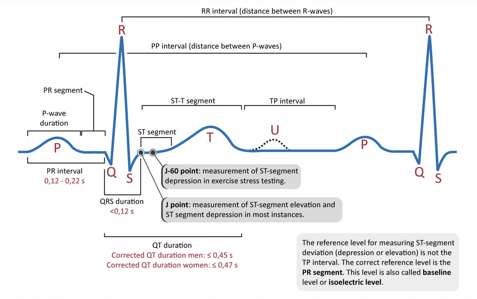 Fiducial points in an ECG signal