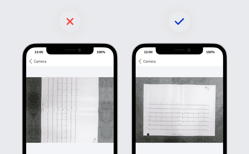 A header image for a blog article guiding PMcardio users to correctly scan their ECG with PMcardio and create their ECG report with success showing the two phone mockups with PMcardio screens