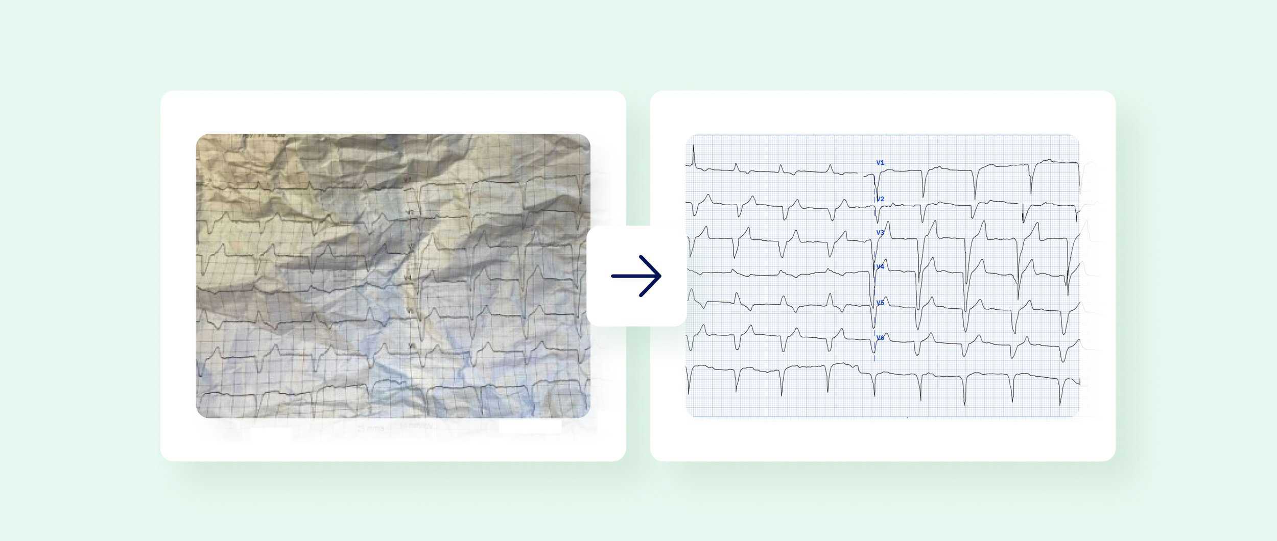 An image of a crumpled, poor-quality ECG and next to it a corrected ECG recording digitized by PMcardio
