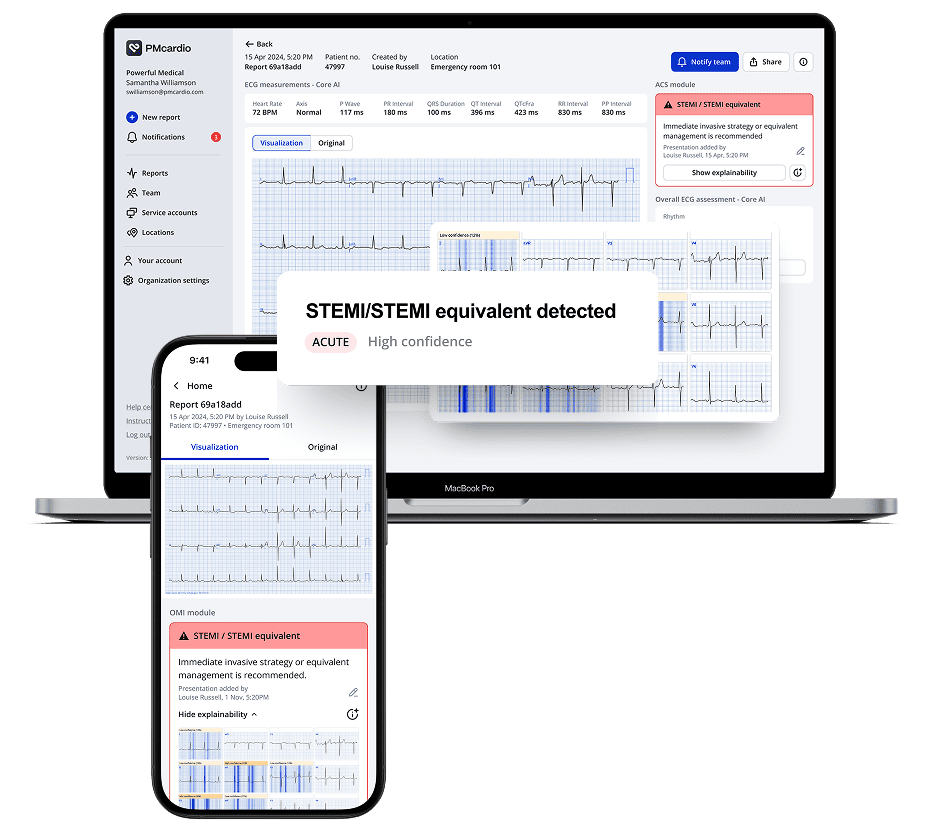 The Explainability Feature in PMcardio: With Human-Centered Design in Mind