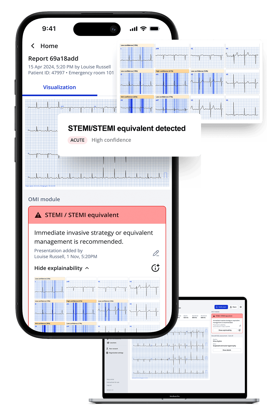 The Explainability Feature in PMcardio: With Human-Centered Design in Mind