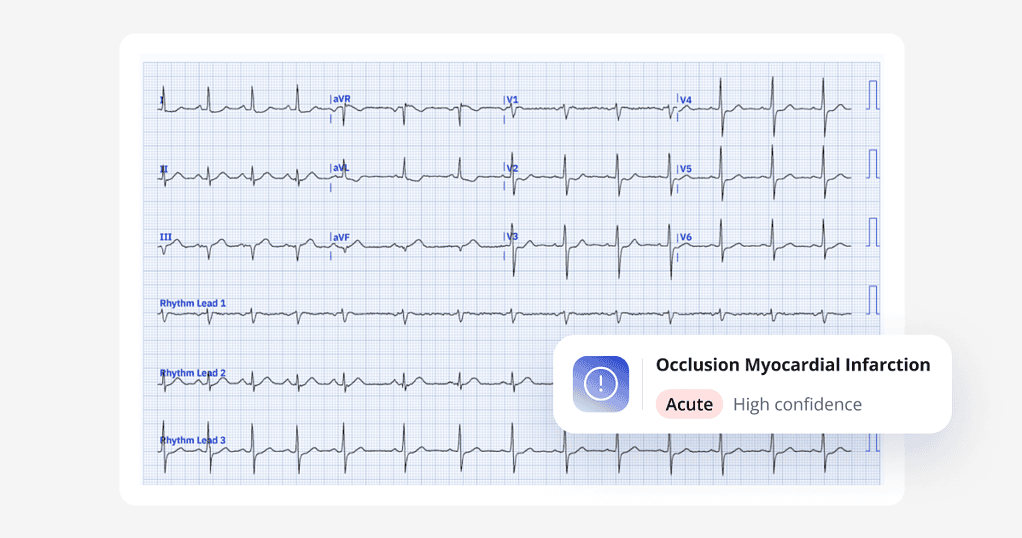 Dr. Schmelzer's Turning Point: How a Severe Chest Pain Case Inspired PMcardio Adoption