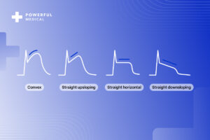 STEMI-ECG-Criteria-ST-elevations-caused-by-ischemia-blog-cover