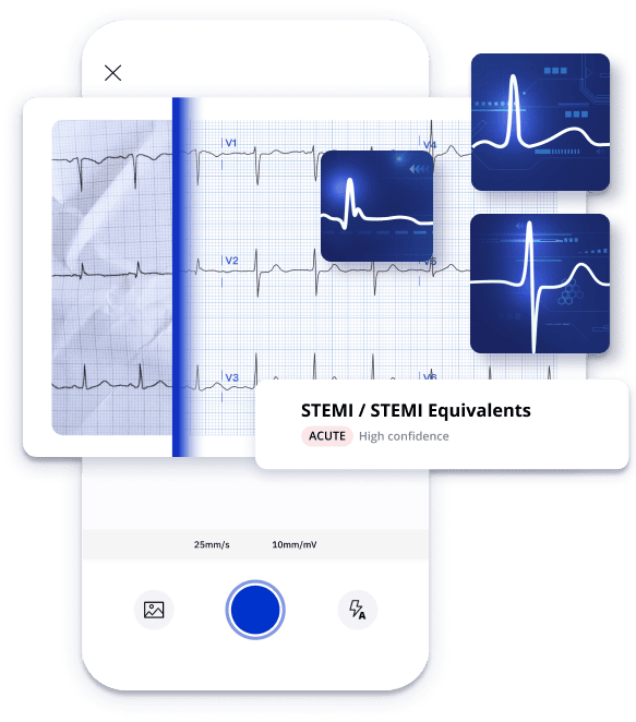 PMcardio STEMI ECG AI MODEL