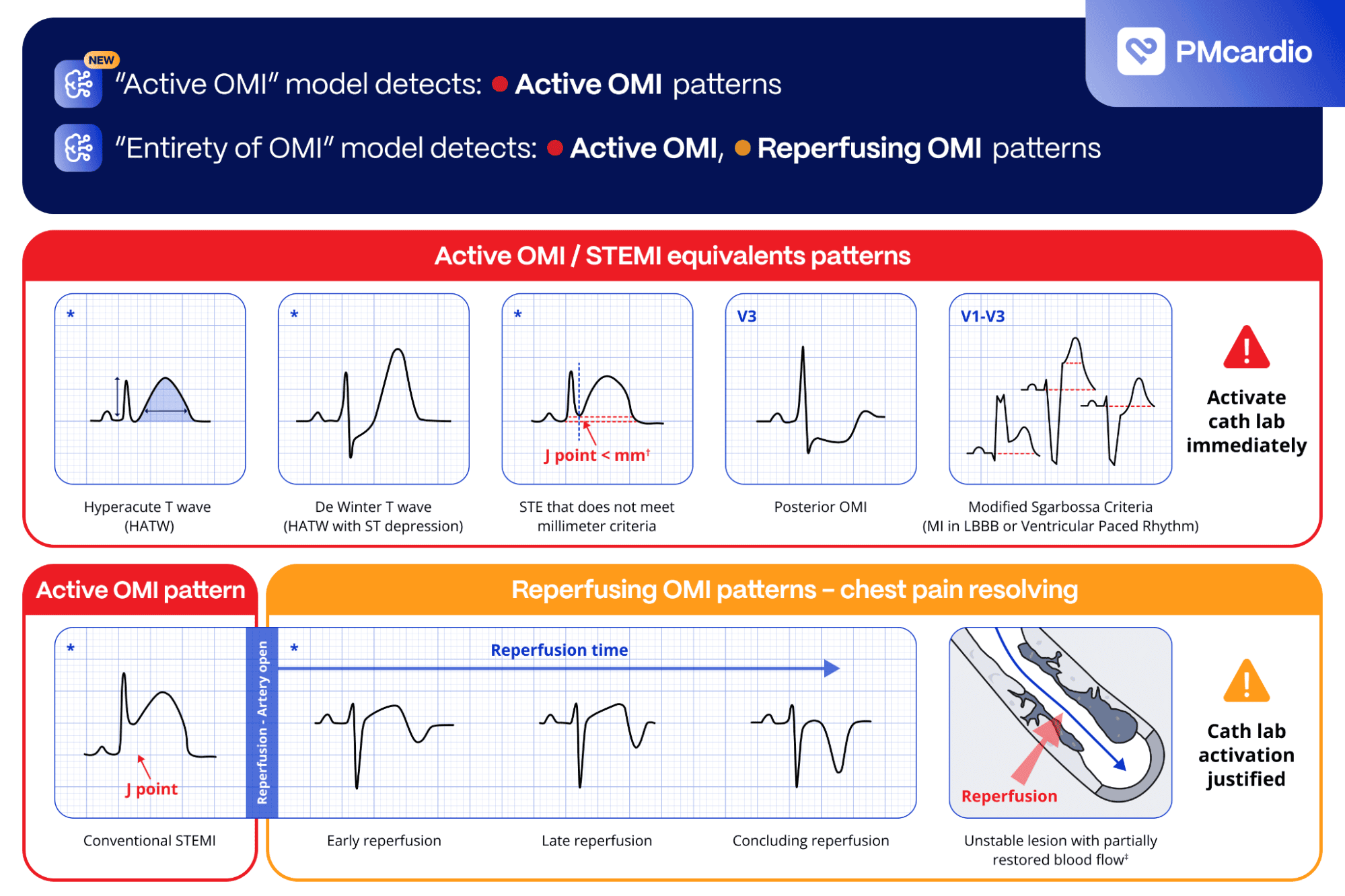 Advanced STEMI Detection and Improved Cath Lab Activation through ECG Transmission and Notifications