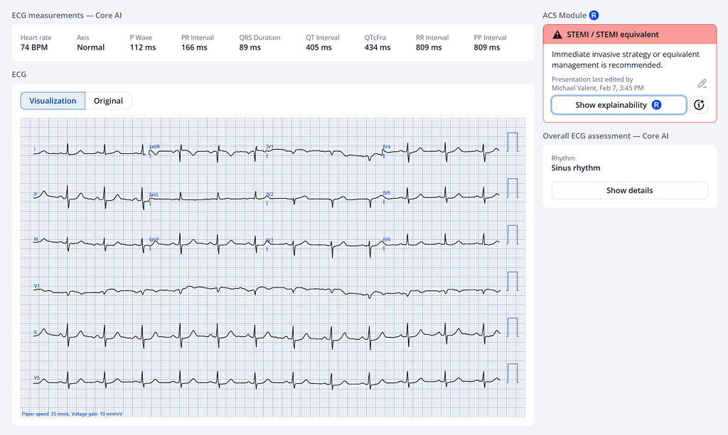 The Explainability Feature in PMcardio: With Human-Centered Design in Mind